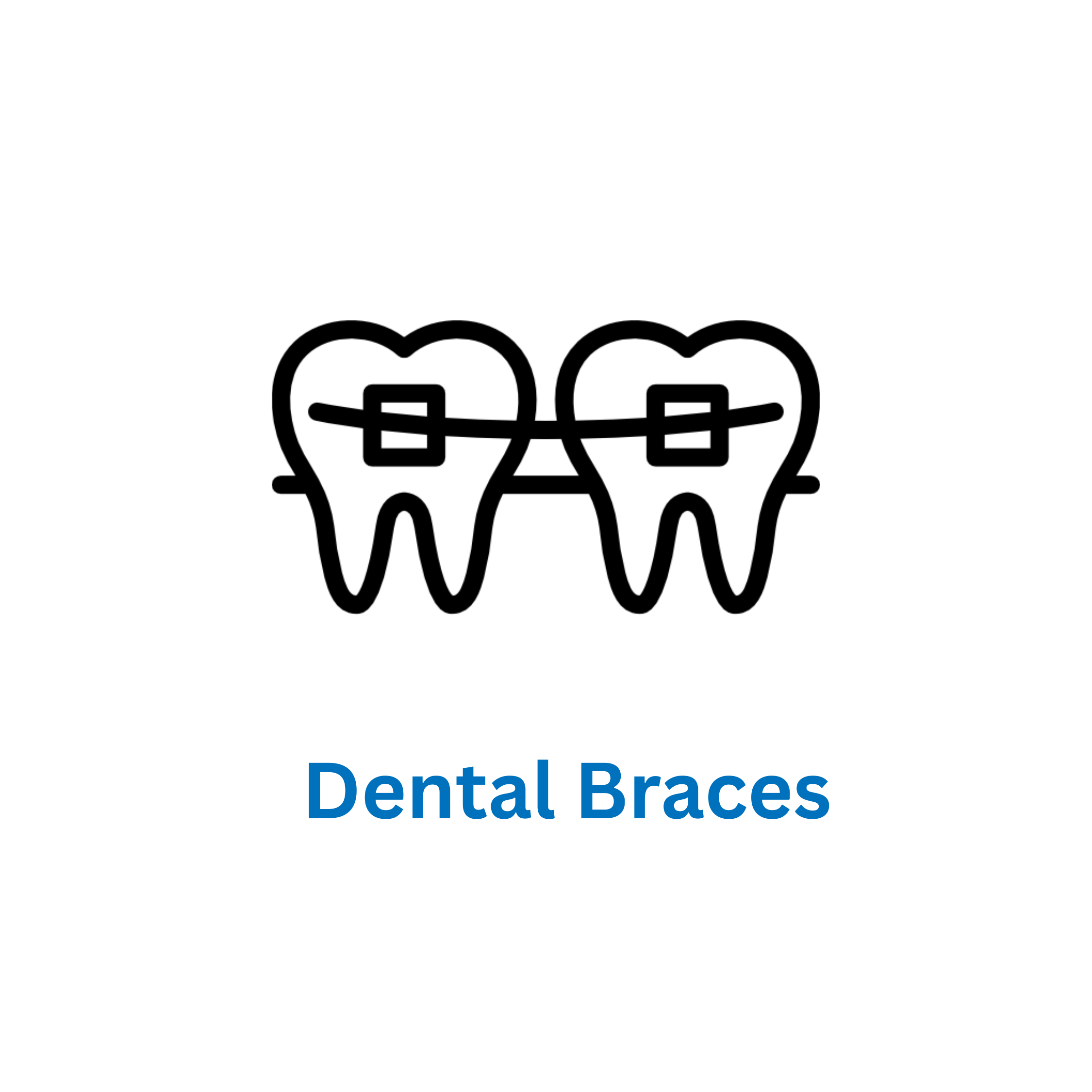 Dental braces is avilable at smile care