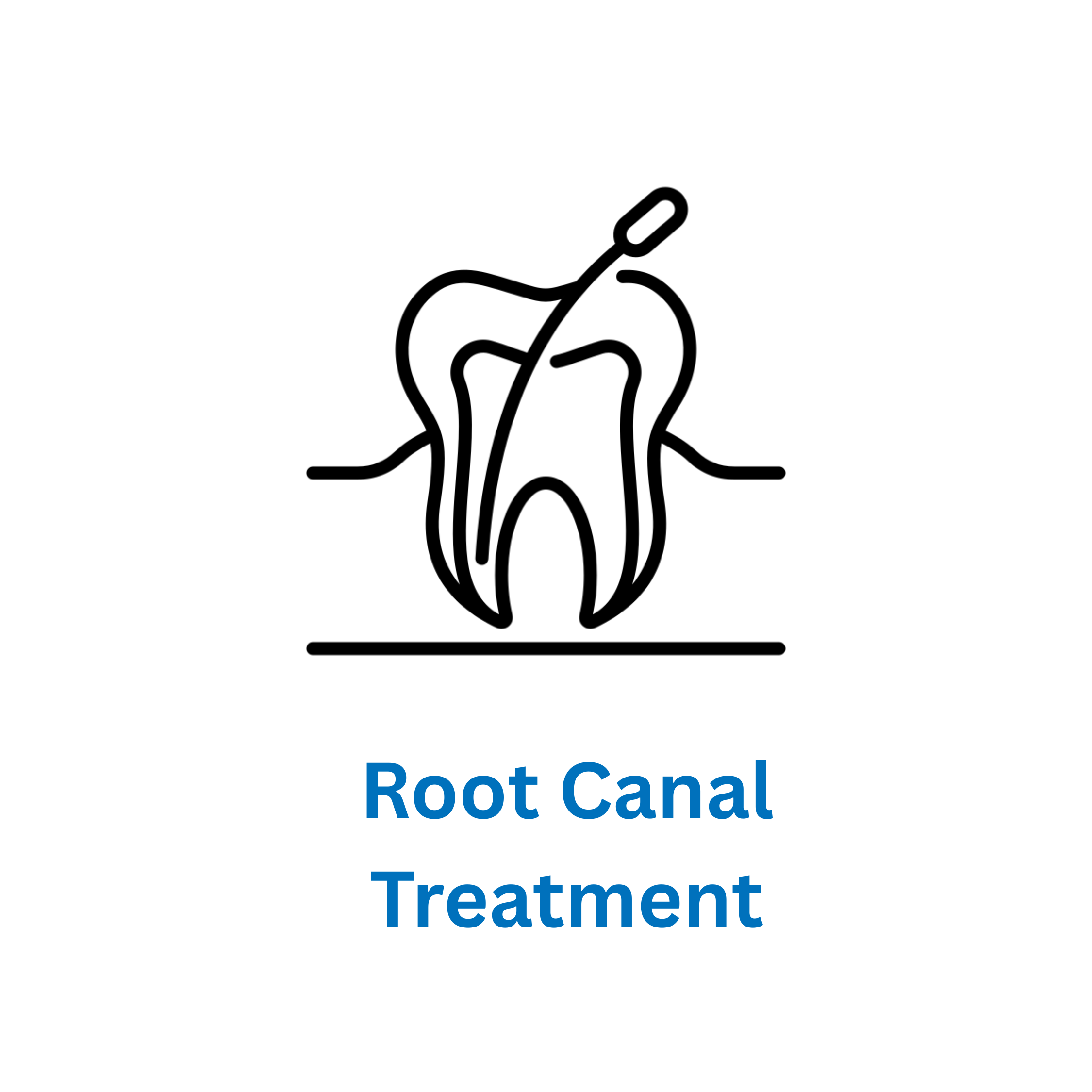 Root canal is avilable at smile care