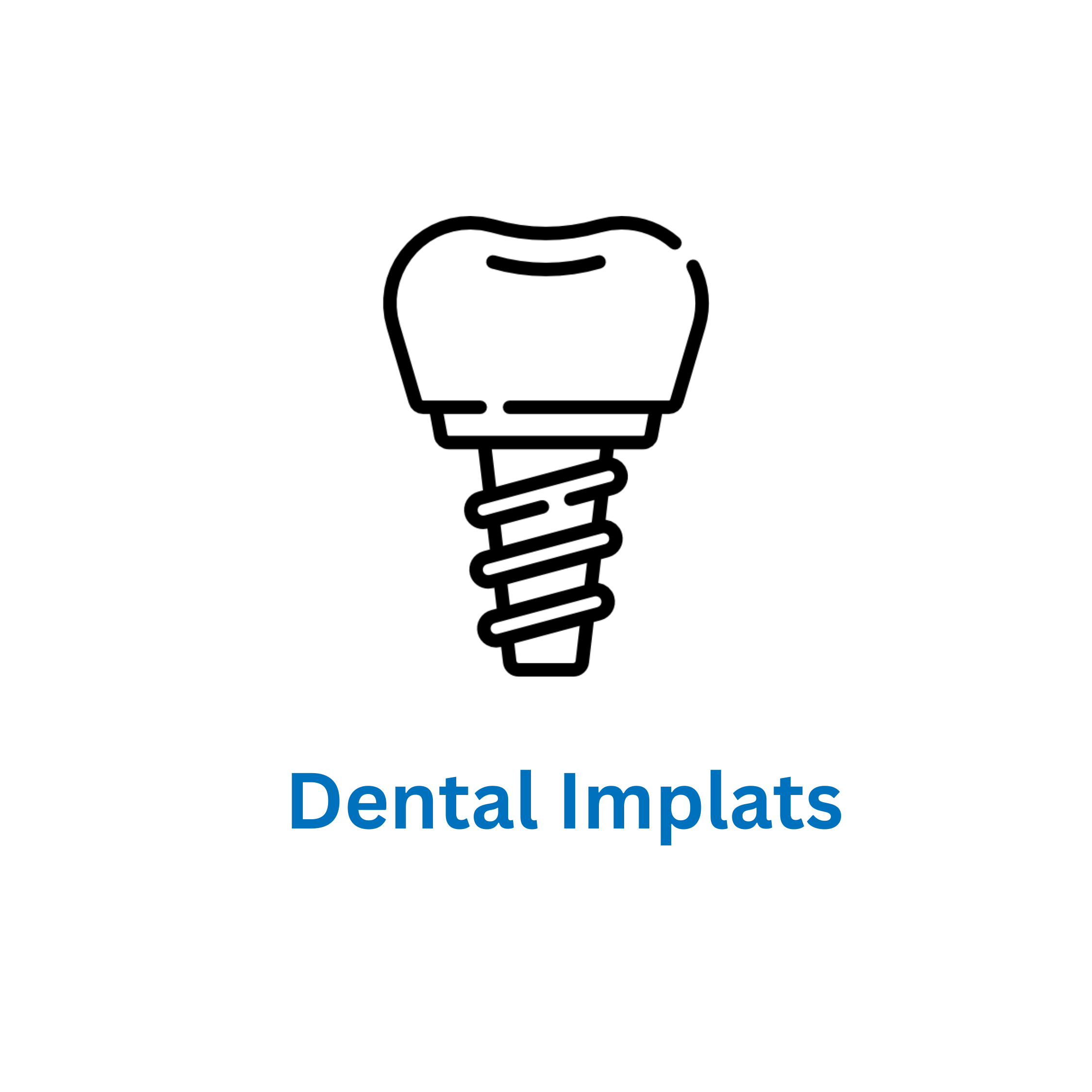 dental implants is avilable at smile care