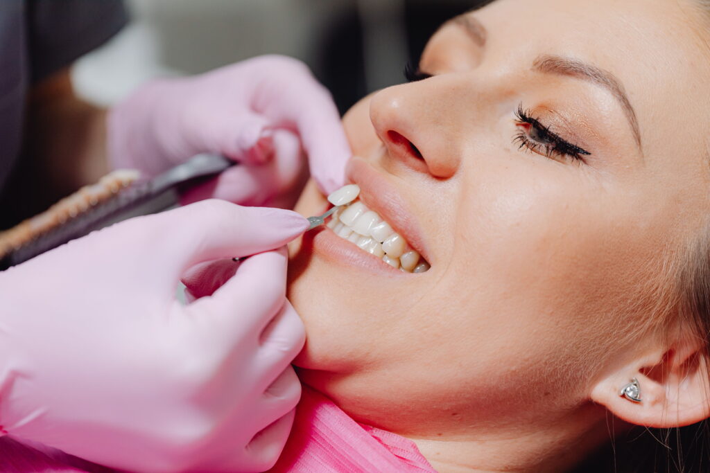 Teeth Whitening in Ahmedabad